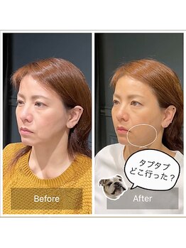 サリエ(S'allier)/お客様のビフォーアフター