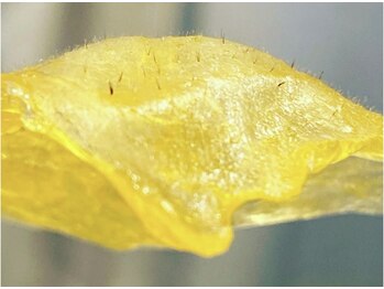 スターリィ スカイ(Starry☆Sky)/フェイシャル脱毛