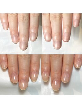 キュア(Cure.)/自爪育成ジェルネイルで健康爪に