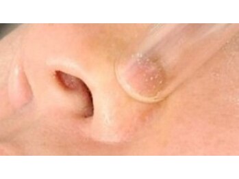 ビューティフェイス ビューティアイラッシュ 岡山天満屋店(BeautyFace Beautyeyelash)/小鼻の汚れを落とします【岡山】