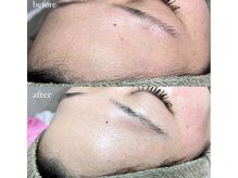 ダブル(W)/フェイシャルWax 生パック