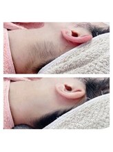 ソルシエール/お顔×うなじ剃り