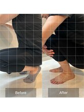 ニコ(NICO)/生まれて初めて踵ついた!!