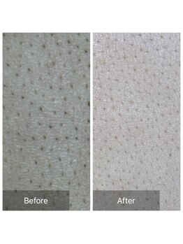 ディーキャットリー(D Catrry)/背中のスキンケアWAX