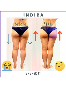 カリド ラボ(CALIDO LAB)/インディバ＆リンパマッサージで