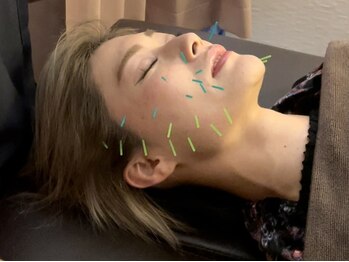 たんぽぽ整骨院鍼灸院