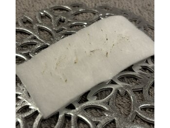 レンリー(Renry)/黒ずみだと思ってたら！？