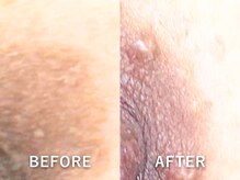 ドアディ(Doordie)/ローマピンク