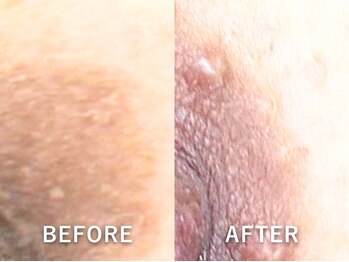 ドアディ(Doordie)/ローマピンク