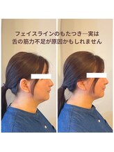 ルフレ(Reflet)/オーラルエステ