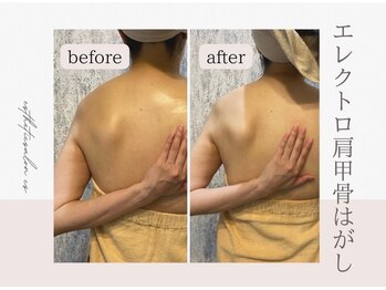 エステティックサロン シーズ/肩甲骨はがし×ほぐし