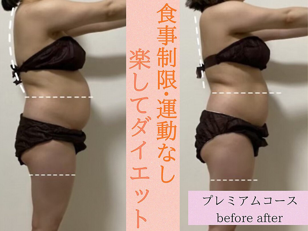 あざみ野駅で痩身が人気のエステサロン｜ホットペッパービューティー