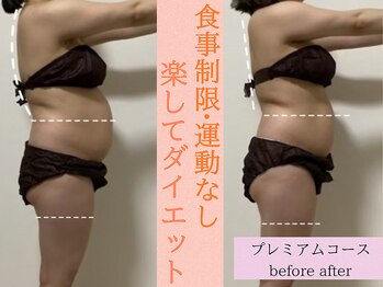 ヨサパーク プア あざみ野(YOSA PARK Pua)