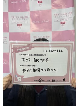 エクシアホワイトニング エミフルMASAKI店/お客様の口コミをご紹介★