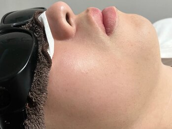 ブレイヴ(BRAVE)の写真/【メンズ専門/完全予約制】脱毛に不安がある方に!丁寧な無料カウンセリングと痛みの少ない脱毛は初回¥660～