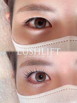 ナナ(7)/上下ラッシュリフト