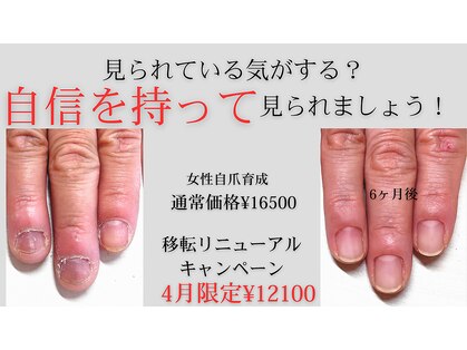 ヴェールリム(verl lim)の写真