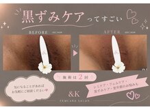 アンドケイ(&K)の雰囲気（黒ずみケアも１回１回しっかり◎プライベート空間でご相談♪）
