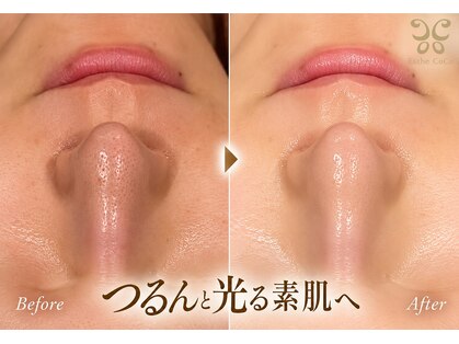 エステ ココ 荻窪店(Esthe CoCo)の写真