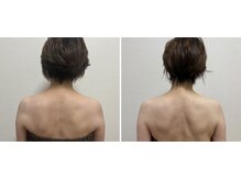 九月屋/お背中の変化もあります