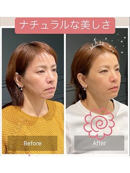 サリエ(S'allier)/お客様のビフォーアフター