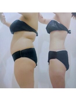 リ オアシス(Re:Oasis)/なかなか落ちない頑固な脂肪も