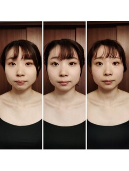 テマモリ(temamori)/施術ビフォーアフター