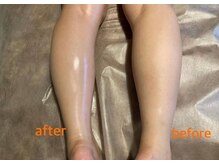 ベリッシモ(bellissimo)の雰囲気（浮腫み/リラクゼーション/マッサージ/リンパ/肩こり/疲労/睡眠）