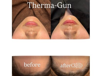 リアンダ(Rianda)の写真