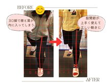 ストレッチ 整体 ホープ(HOPE)/膝の痛みを改善