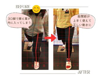 ストレッチ 整体 ホープ(HOPE)/膝の痛みを改善