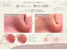 ウルル 上野店(ULULU)の雰囲気(【大人気の毛穴洗浄!!】ちゅるっとお肌でメイクのり抜群★)