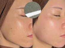 ルーナジェーナ(Luna llena)/池袋　エステ　ルーナジェーナ