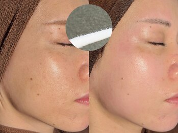 ルーナジェーナ(Luna llena)/池袋　エステ　ルーナジェーナ