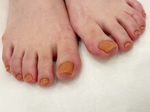 BBG 上野店/フットネイル