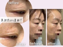 キャメル ネイル(camel nail)/目元のクマ・シワ・ハリ