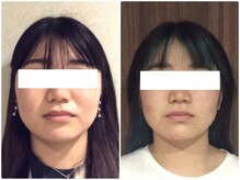 美容整体 ウェリナ 蟹江院/小顔矯正/骨盤矯正/美脚サロン 