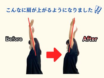アオ(ao)/整体 Before→After