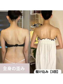 蒼(so)/わずか3回劇的ビフォーアフター