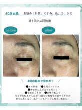 サロン アンネ(Anne)/