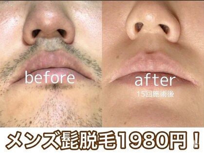 トータルビューティケア アヤ(Aya)の写真