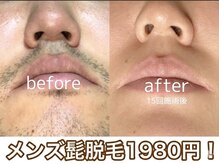 トータルビューティケア アヤ(Aya)