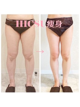 デジール(DESIR)/美脚を目指して5か月の成果！！