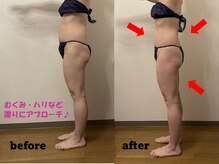 レーヴリゼ(Revelise)/血流改善/温熱リンパマッサージ