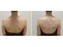 九月屋/肩甲骨が元の位置へと整います