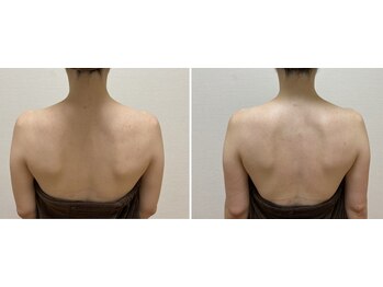 九月屋/肩甲骨が元の位置へと整います