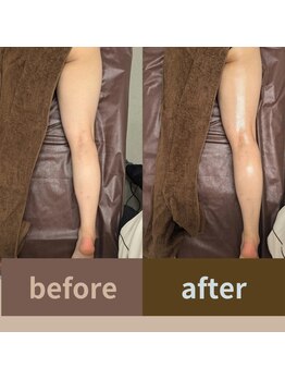 めぐりねこ/リンパ/痩身/小顔/たるみケア