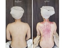 リュクス(Luxe)/頭痛がなくなった(30代)