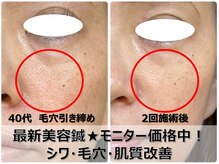 皇漢堂鍼灸療院の雰囲気（毛穴が気になる方は★最新美容鍼【ダーマ鍼】8/31まで特別価格）