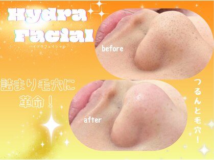 ルポ(repos)の写真